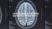 Maladie de Borna : infection mortelle du cerveau