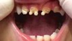 Cet enfant s'est retrouvé avec les dents dans un état lamentable... la raison est étonnante