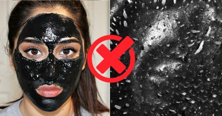 Les dangers du masque au charbon et à la colle contre les points noirs