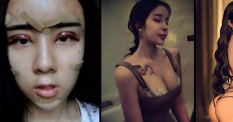 Lee Hee Danae : à 16 ans, cette adolescente enchaîne les opérations de chirurgie esthétique pour reconquérir son ex