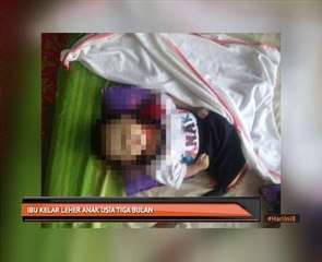 Ibu kelar leher anak usia tiga bulan