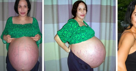 La nouvelle vie de cette maman qui a accouché d'octuplés va vous surprendre !
