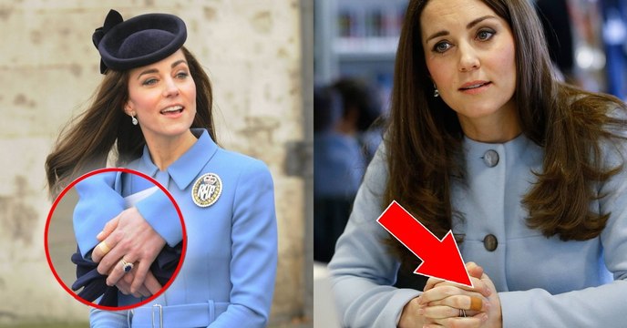Kate Middleton : voilà pourquoi la princesse a toujours un pansement au doigt