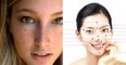 Les grains de beauté sur ces 5 parties du visage en disent beaucoup sur votre personnalité