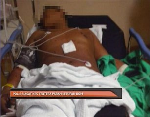 Polis siasat kes tentera parah letupan bom