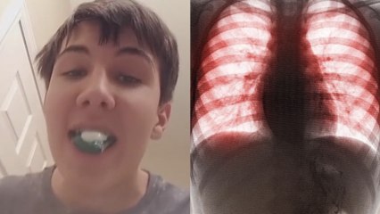 Tide Pod Challenge : les conséquences désastreuses du challenge sur un ado