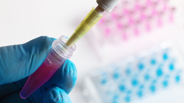 Test génétique pour éviter les cancers héréditaires : ça concerne qui ?