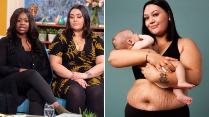 Ces mamans montrent leur ventre post-accouchement et reçoivent une pluie de critiques