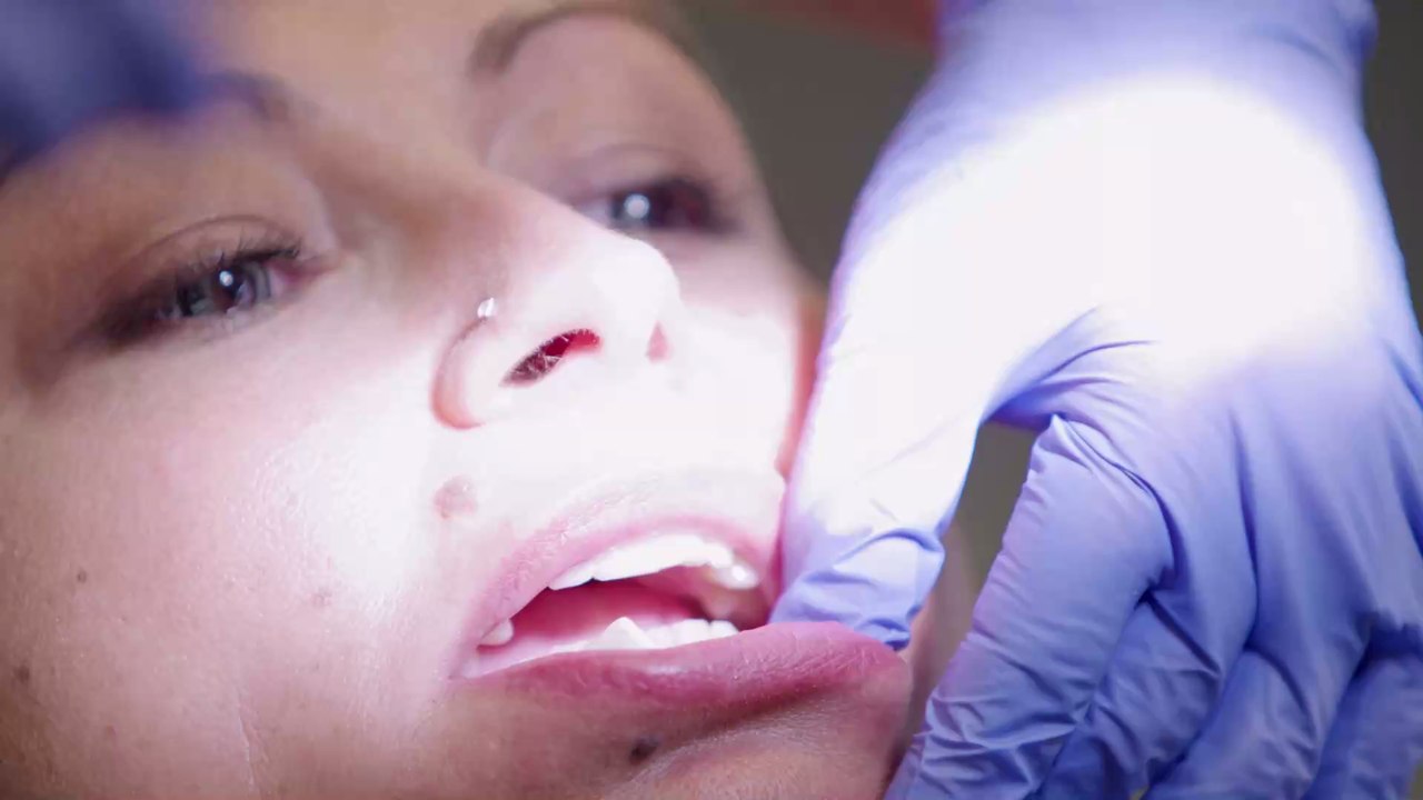 Cette femme a les plus grosses lèvres du monde et les chirurgiens n'acceptent plus de l'opérer !