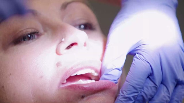 Cette femme a les plus grosses lèvres du monde et les chirurgiens n'acceptent plus de l'opérer !