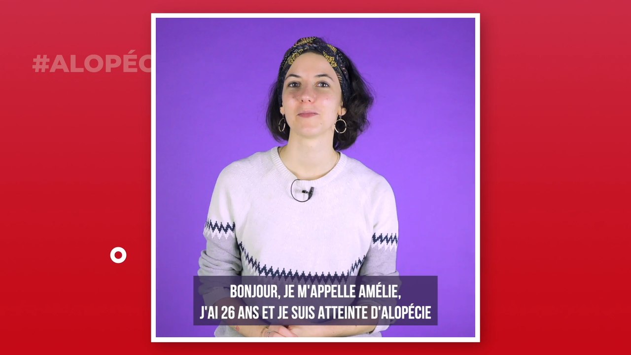 Alopécie : symptômes, causes, traitement, quelle est cette maladie qui fait perdre ses cheveux ?