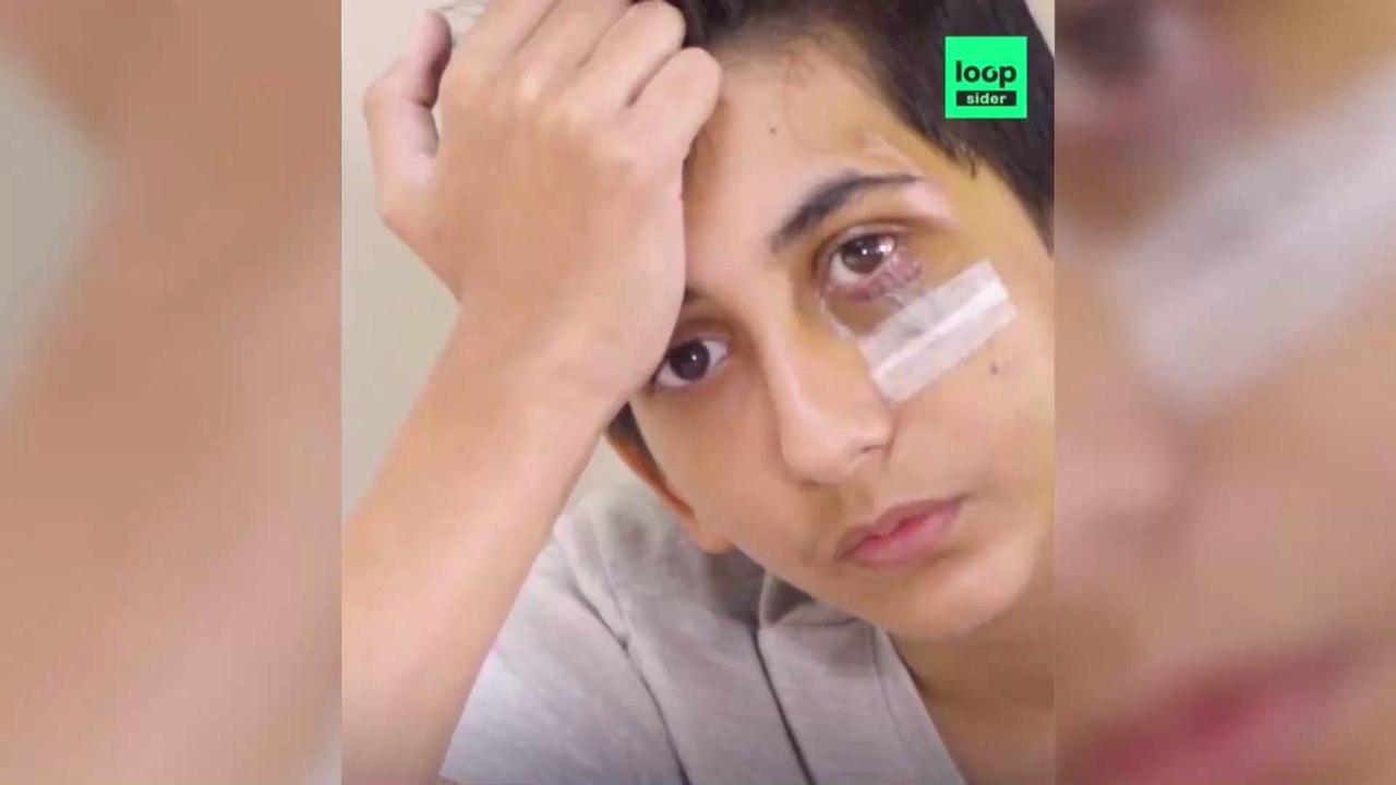 Violences policières : suite à sa violente interpellation, Gabriel 14 ans raconte son histoire