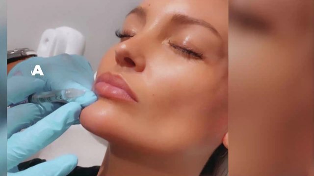 Aurélie Dotremont documente sa nouvelle opération esthétique