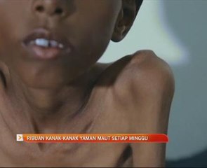 Ribuan kanak-kanak Yaman maut setiap minggu