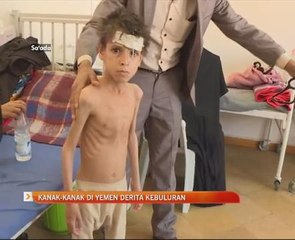 Kanak-kanak di Yemen derita kebuluran