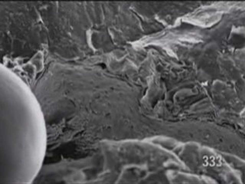 Zoom into Human Skin