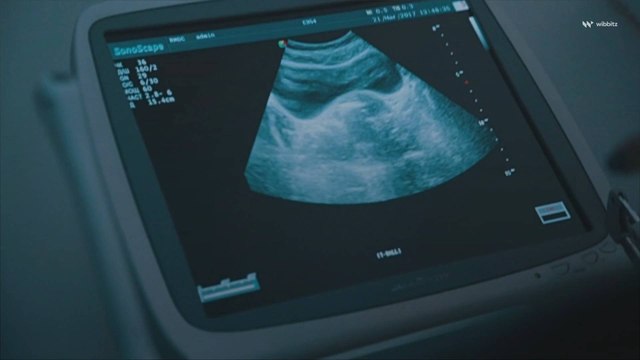 Florida Senate Passes Bill Banning Abortions After 15 Weeks