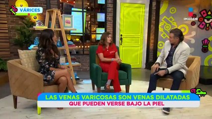 Varices: Tipos, consecuencias, riesgos y más