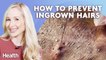 Dermatologist Explains How to Prevent Ingrown Hairs, Vitamin C Serum, and More | Ask An Expert
