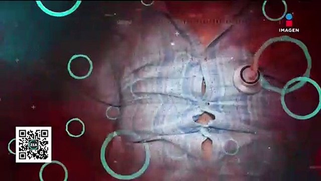 Obesidad, una problema de salud que trae consecuencias para todos