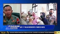 Live Dialog Kapolres Banjarnegara Bocah 17 Bulan Penderita Tumor Mata
