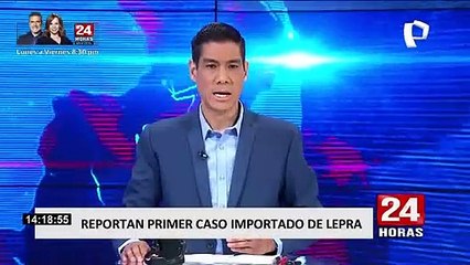Tumbes: detectan primer caso de lepra en extranjero proveniente de Brasil