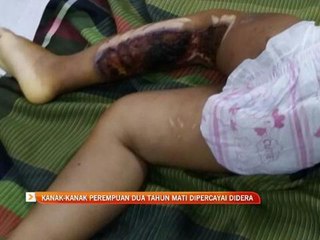 Kanak-kanak perempuan dua tahun mati dipercayai didera