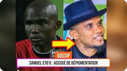 Accusé de se dépigmenter, Samuel Eto’o réagit : Je suis fermement contre le blanchiment de la peau.