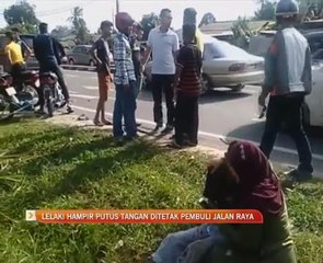 Lelaki hampir putus tangan ditetak pembuli jalan raya