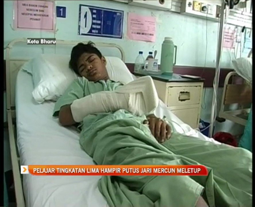 Pelajar tingkatan lima hampir putus jari mercun...