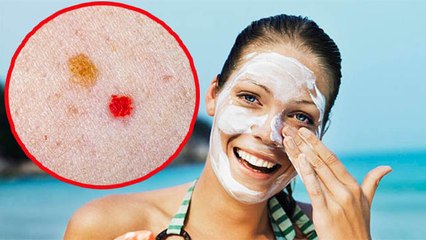 Sunscreeen लगाने की वजह से क्या सच में हो सकता है Skin Cancer | Boldsky