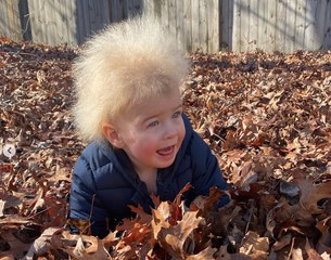 Cet petit garçon souffre du "syndrome des cheveux incoiffables" et c'est trop mignon