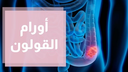 آذار شهر التوعية العالمي لأورام القولون