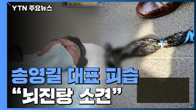 송영길, 선거운동 중 '망치 피습'...응급실 옮겨져 치료 / YTN