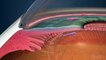 Las enfermedades oculares cada vez más frecuentes entre los españoles
