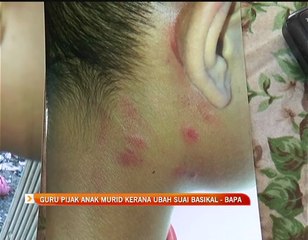 Guru pijak anak murid kerana ubah suai basikal - Bapa