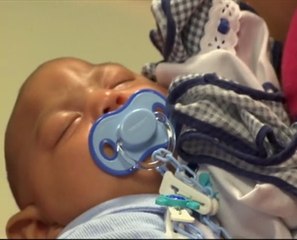 Microcephaly: Bayi mungkin dapat membesar seperti biasa