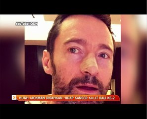 Hugh Jackman disahkan hidap kanser kulit kali ke-2
