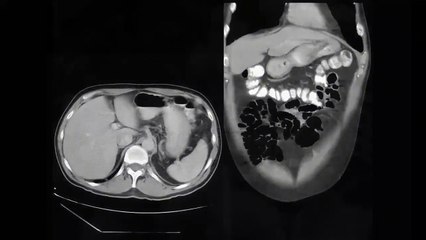 Tudo Começou Pelo Fim Teaser Original