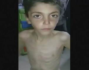 Warnings of widespread starvation growing in besieged Syrian town