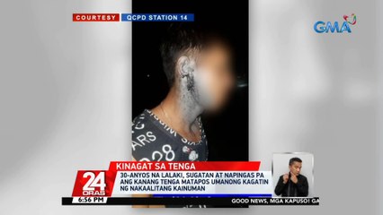 30-anyos na lalaki, sugatan at napingas pa ang kanang tenga matapos umanong kagatin ng nakaalitang kainuman | 24 Oras