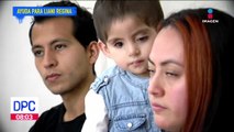 Niña de 2 años fue diagnosticada con cáncer en los ojos y necesita ayuda para su tratamiento