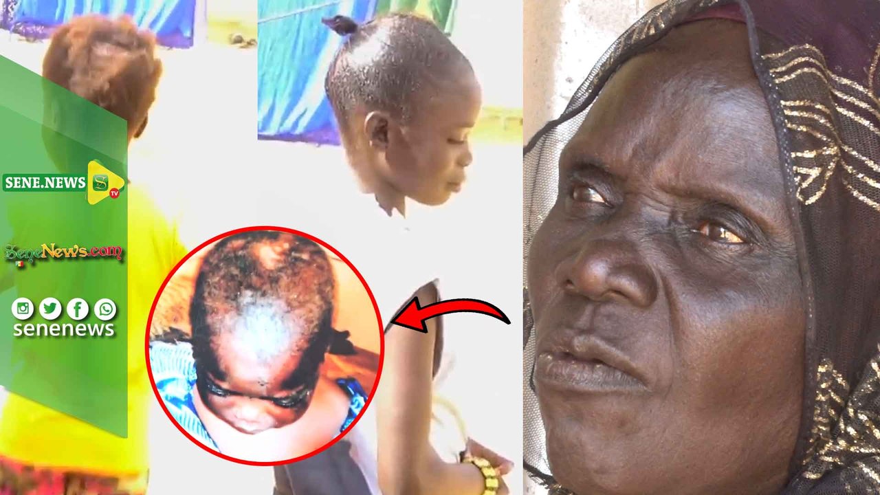 8Mars:Les tristes confidences de la grand-mère des 2 jeunes filles rendues aveugles par leur tante