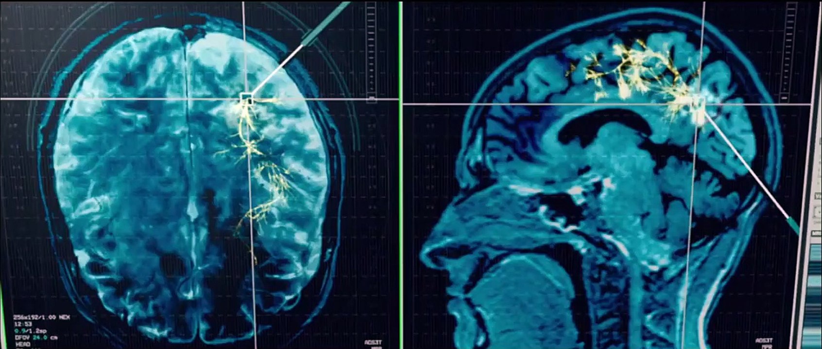 Das Jerico Projekt - Im Kopf des Killers Trailer DF