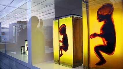 Das dunkle Gen Trailer DF