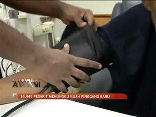 16,499 pesakit menunggu buah pinggang baru