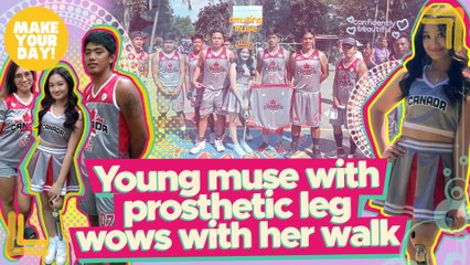 Young muse with prosthetic leg wows with her walk | Make Your Day