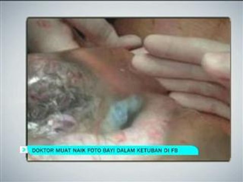 Doktor muat naik foto bayi dalam ketuban