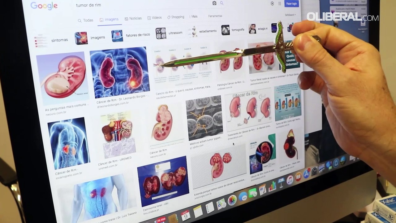 Confira as principais dicas para manter os rins saudáveis