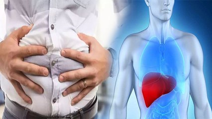 Bloated Stomach इस जानलेवा बीमारी के Symptoms, क्या है कारण और उपाय | Boldsky